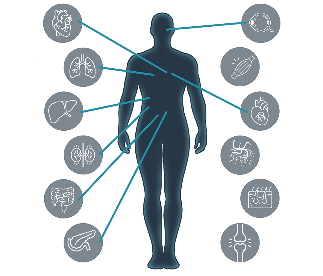 Graphic of a man surrounded by smaller graphics of organs,